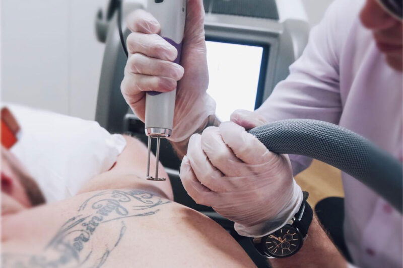 6 Best Tattoo Removal Clinics In Sydney