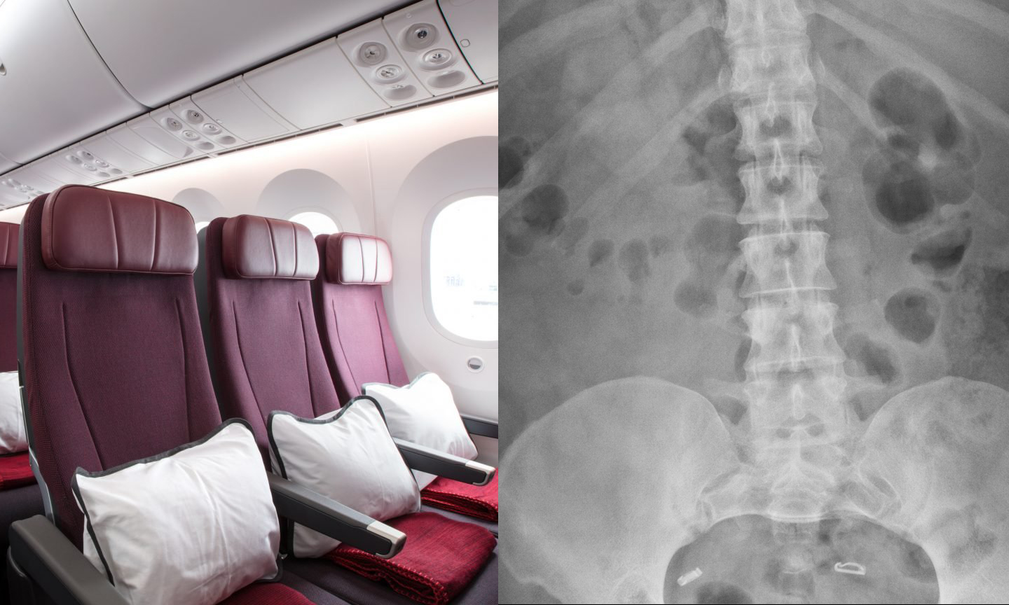 What Happens To Your Body On Ultra Long Haul Flights