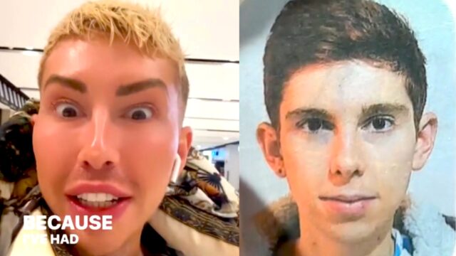 Aussie Drag Queen Stopped By Airport Security After ‘So Much’ Plastic Surgery