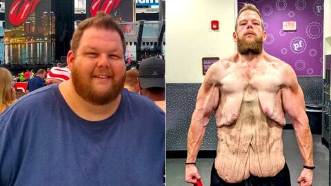 Man Who Lost 160kg In Stunning Body Transformation Reveals Unexpected Side Effect
