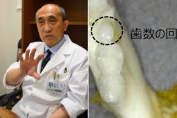 Jaw-Dropping Japanese Drug That Regrows Teeth Could Kill Off Dentures & Implants Forever
