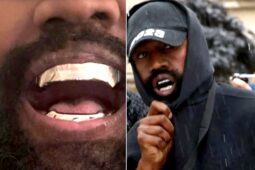 Kanye West Surgically Removes Teeth, Replaces Them With $1.3 Million Bond-Villain Dentures